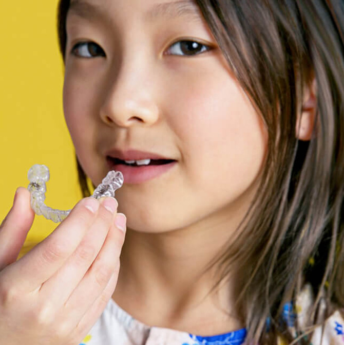 Lente de Contato Dental em Campinas