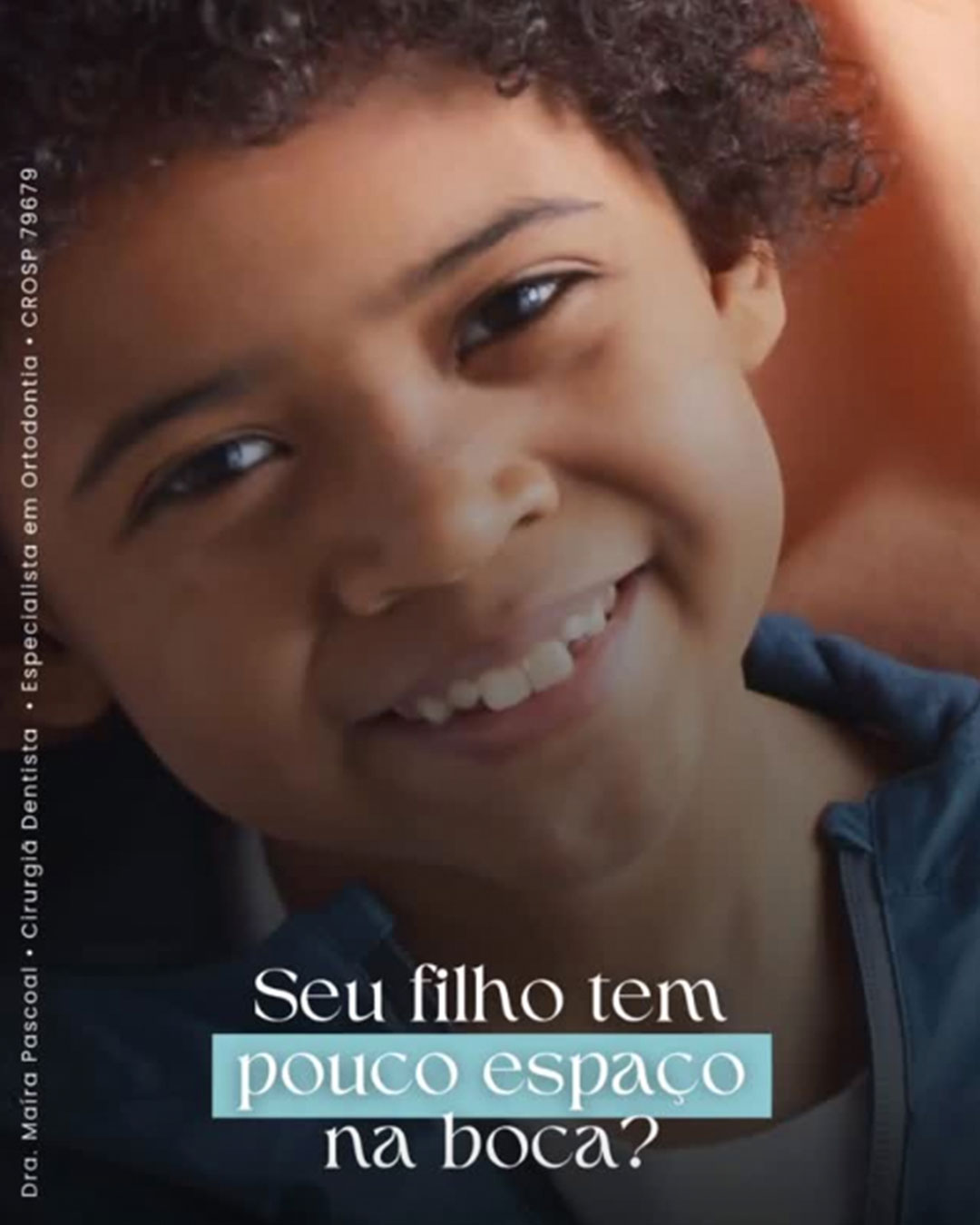 Seu filho tem pouco espaço na boca? Conheça o Expansor Palatino Invisalign®