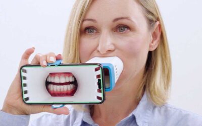 Invisalign® Virtual Care AI com Invisalign Lens