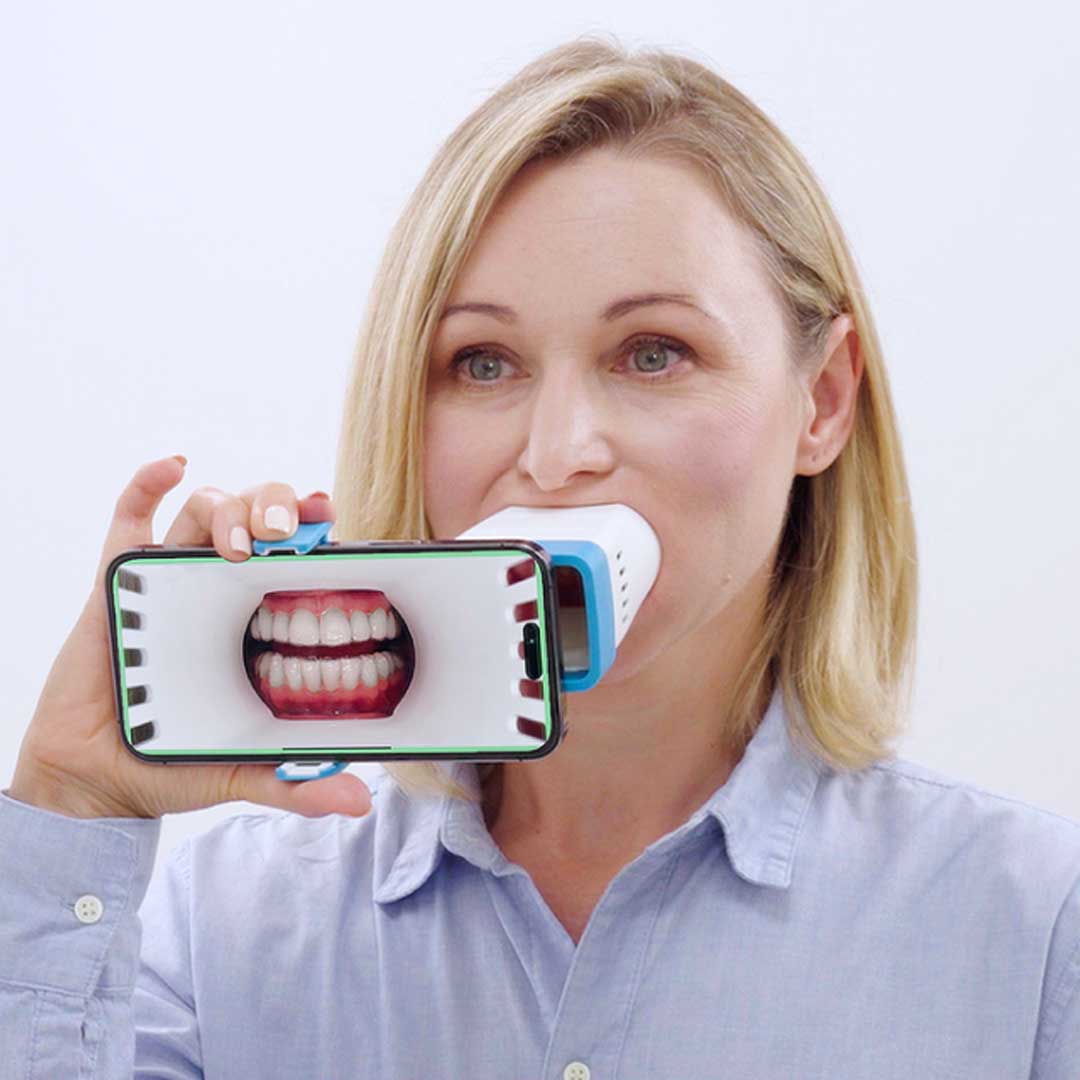 Invisalign® Virtual Care AI com Invisalign™ Lens