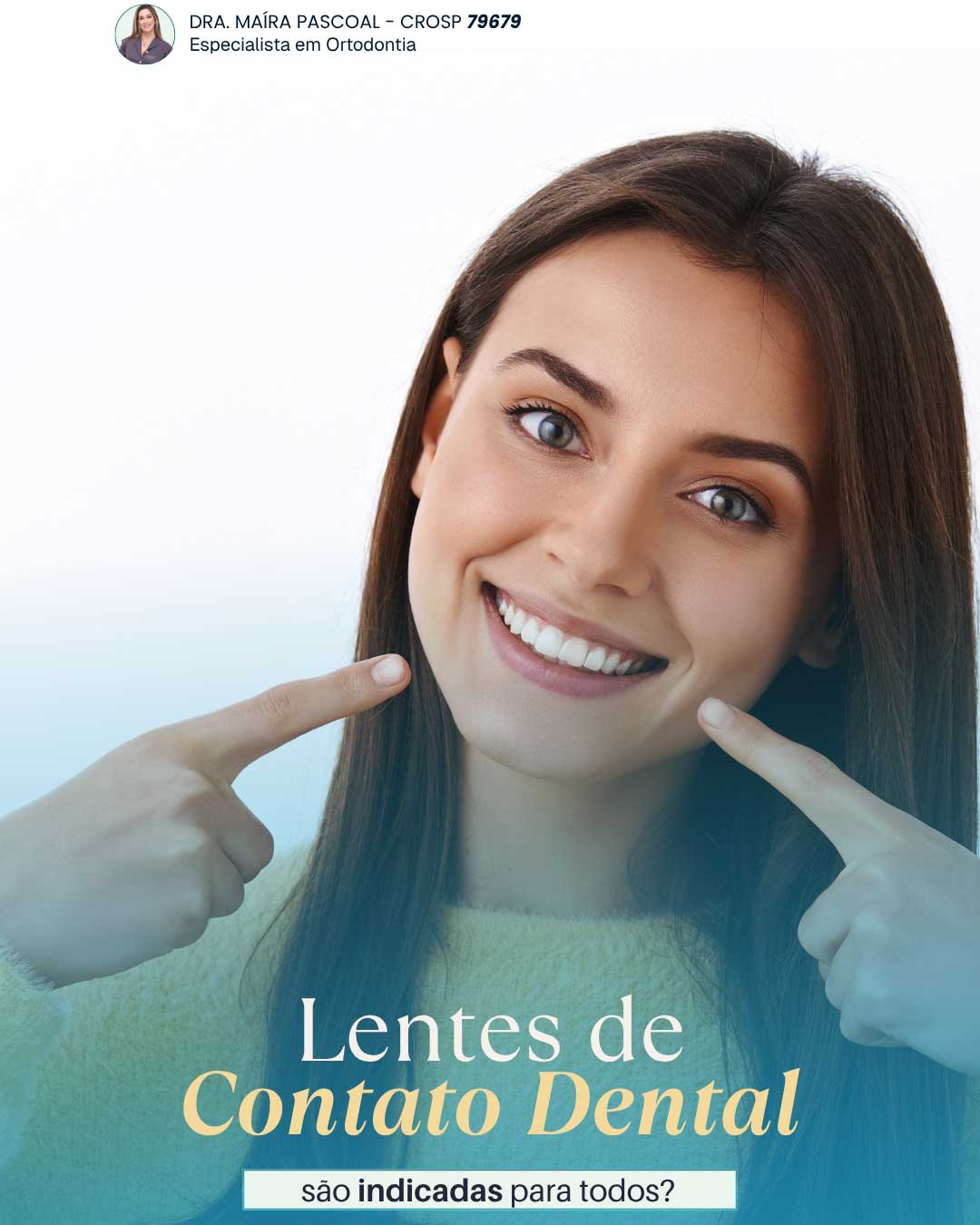 Lente de Contato Dental em Campinas Lente de Contato Dental em Campinas